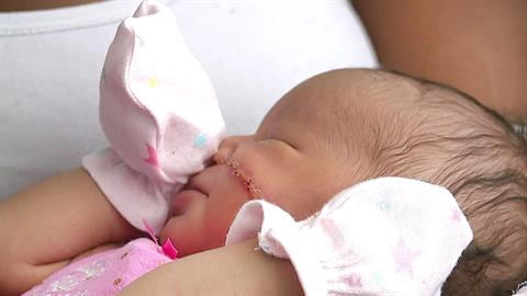 Νεογέννητο χρειάστηκε 13 ράμματα στο πρόσωπο μετά από ατύχημα στην καισαρική