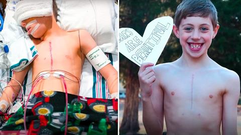 Πρωτοποριακή εγχείρηση χάρισε μια υγιή ζωή σε παιδί που ήταν καταδικασμένο