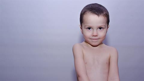 Ο 3,5 χρονών γιος μου τελευταία βγάζει όλα τα ρούχα του και κυκλοφορεί γυμνός στο σπίτι. Τι σημαίνει όλο αυτό;