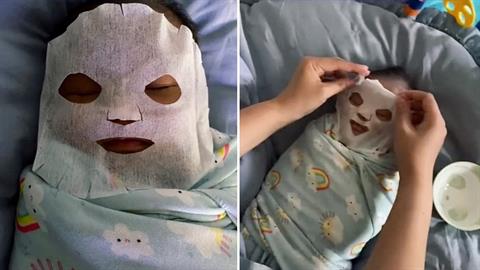 Μαμά έφτιαξε μάσκα προσώπου κατά της βρεφικής ακμής από... μητρικό γάλα!