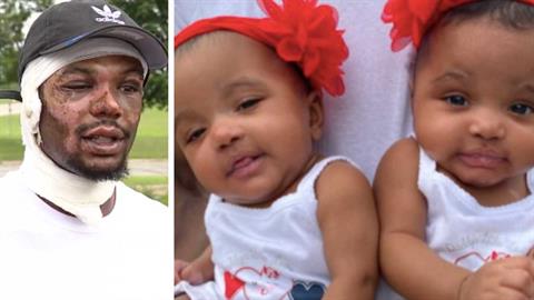 Πατέρας ρίχτηκε στις φλόγες κι έσωσε τα διδυμάκια του από βέβαιο θάνατο