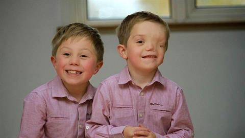 Γιατί οι άνθρωποι δεν μπορούν να δουν πέρα από τη δυσμορφία του παιδιού μου;