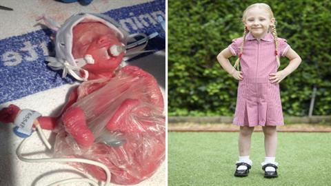 Πρόωρο μωράκι που γεννήθηκε 600 γρ. κοντεύει τα 4 και πάει πρώτη φορά σχολείο!