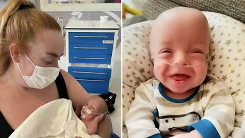 Πρόωρο μωρό με μόλις 1% πιθανότητα να επιβιώσει κέρδισε τη μάχη της ζωής