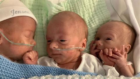 3δυμα μοιράστηκαν τον ίδιο πλακούντα - Συμβαίνει 1 στα 200 εκατομμύρια