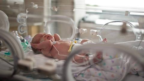 Βρέφος 40 ημερών με καρδιοπάθεια δίνει μάχη για τη ζωή του