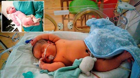 Μαμά γέννησε έναν μικρό... γίγαντα με βάρος σχεδόν 7 κιλά!