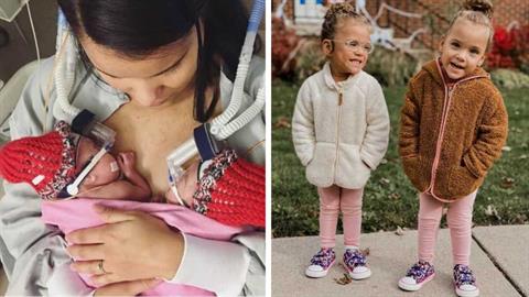 Μου είπαν ότι τα διδυμάκια μου θα πέθαιναν στον τοκετό - σήμερα είναι 3 ετών