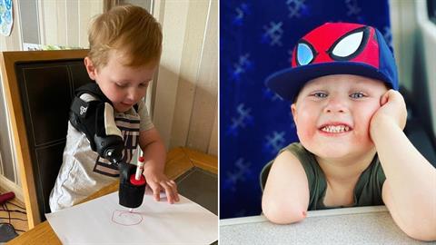 Ο γιος μας νιώθει δυνατός κι ας έχει ένα χέρι - οι άλλοι νιώθουν άβολα μαζί του