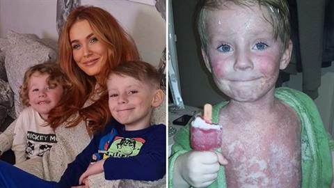 Ο γιος μας ζει με μια βασανιστική ασθένεια, αλλά δεν χάνει ποτέ το χαμόγελό του 