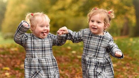 2χρονη με σύνδρομο Down περπάτησε με τη βοήθεια της δίδυμης αδερφής της