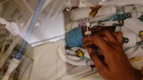 Προωράκι που γεννήθηκε 380 γραμμάρια πάλεψε για τη ζωή του και κέρδισε