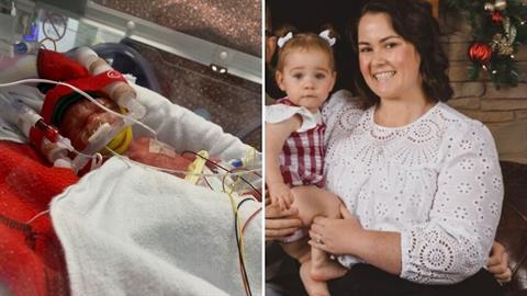 Πρόωρο μωρό που γεννήθηκε στις 24 εβδομάδες τα κατάφερε και σήμερα γίνεται ενός