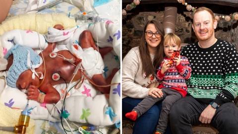 Μωράκι θα κάνει 1η φορά γιορτές σπίτι του μετά από 2 χρόνια στο νοσοκομείο