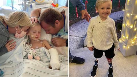 4χρονος περπάτησε με προσθετικά μέλη - σοκάρει ο τρόπος που έχασε τα πόδια του