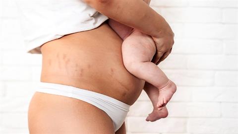 «Μόλις γέννησα κι έχω πιο σημαντικά πράγματα να ανησυχώ από το βάρος μου»