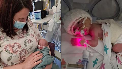 Το προωράκι τους πάλευε 3 μήνες με το θάνατο - τώρα το κρατούν στην αγκαλιά τους!