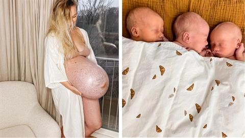 Μαμά περιγράφει πώς είναι να γεννάς 3δυμα: «άξιζαν και οι 36 ώρες πόνου!»