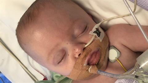 Προωράκι έκλεισε 6 ολόκληρους μήνες στο νοσοκομείο παλεύοντας για τη ζωή του