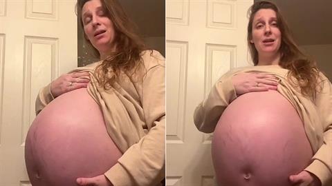 Ετοιμόγεννη που περιμένει 1 μωρό μοιάζει σαν να περιμένει τουλάχιστον 4!