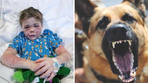 7χρονος δέχτηκε φονική επίθεση από σκύλο – τον έσωσε μια γειτόνισσα