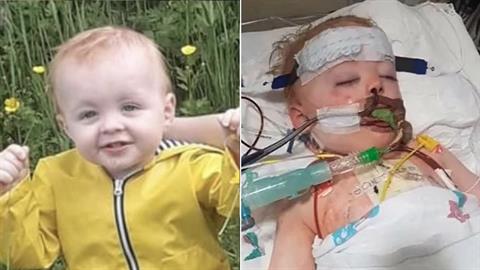 Αγοράκι 1 έτους κατάπιε μπαταρία και πέθανε - του άνοιξε τρύπα στην καρδιά!