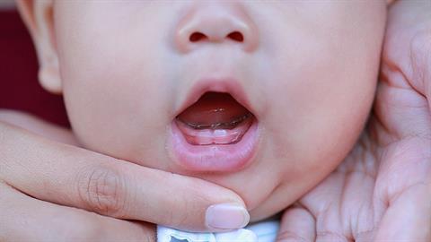 Παιδίατρος: μην αποδίδετε τα πάντα στο ότι το μωρό «βγάζει δοντάκια»