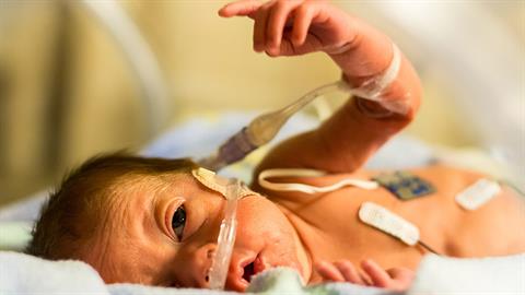Δεν θα ξεχάσω ποτέ το διασωληνωμένο κορμάκι του πρόωρου μωρού μου στη ΜΕΘ