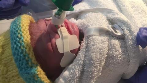 Το μωρό μας γεννήθηκε με μισή καρδιά - περιμένουμε την σωτήρια επέμβαση 