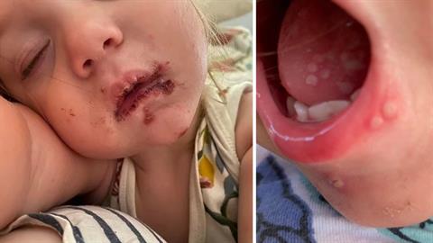 Μην αφήνετε κανέναν να φιλάει τα μωρά σας - το δικό μου κινδύνευσε σοβαρά!