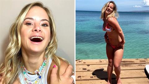  Το νέο μοντέλο της Victoria’s Secret είναι ένα υπέροχο κορίτσι με σύνδρομο Down!