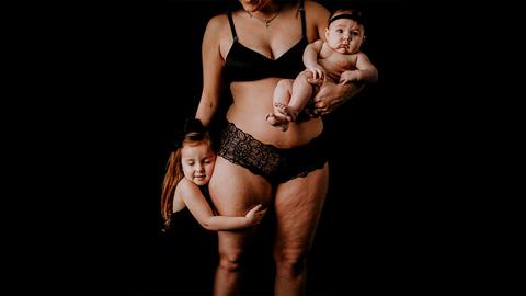 Έμαθα να αγαπώ το σώμα μου με τις ατέλειές του για το καλό της κόρης μου