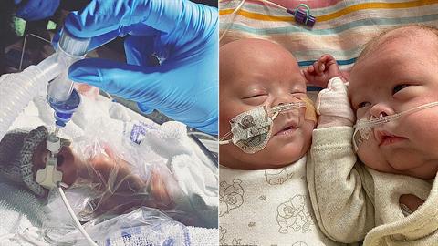 Προωράκια με ελάχιστες πιθανότητες να ζήσουν έγιναν 5 μηνών και πήγαν σπίτι τους!