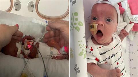 Προωράκι που γεννήθηκε 425 γραμμάρια πάει επιτέλους σπίτι του μετά από 5 μήνες!