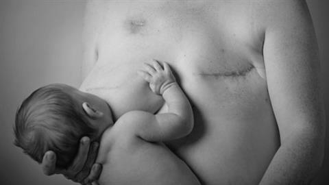 «Η μαστεκτομή δεν με εμπόδισε να θηλάσω - ένα στήθος μπορεί να φτάνει για δύο»