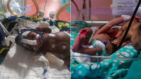 Προωράκι πάει επιτέλους σπίτι του μετά από 15 μήνες στη ΜΕΘ!