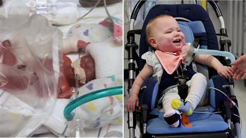 Προωράκι πάει πρώτη φορά σπίτι του μετά από 19 ολόκληρους μήνες στο νοσοκομείο!