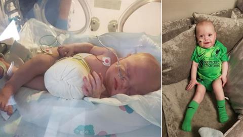 Μωράκι με ελάχιστες πιθανότητες να επιβιώσει στον τοκετό, έγινε 10 μηνών!