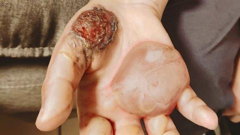 Αστυνομικός για την υπόθεση κακοποίησης 10χρονης: «η σιωπή πρέπει να μας σοκάρει»