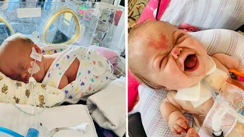 Της έδιναν μόνο λίγες ώρες ζωής αλλά νίκησε τον θάνατο και έγινε 18 μηνών