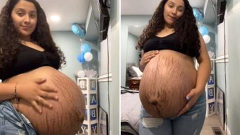 «Περιμένω 2δυμα και η κοιλιά μου είναι τόσο μεγάλη σαν να είμαι έγκυος σε 4δυμα»