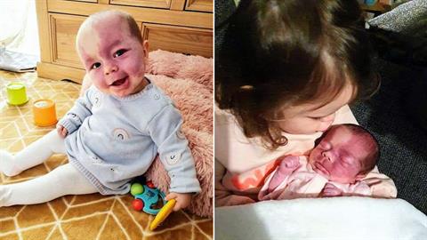 Η ιστορία του κοριτσιού με το μοβ πρόσωπο: «είναι μια αληθινή μαχήτρια»