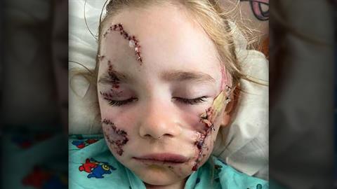 2 αδερφάκια και η μαμά τους δέχτηκαν άγρια επίθεση από σκύλο