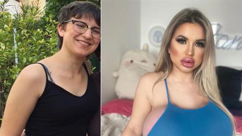 21χρονη ξόδεψε 65.000 ευρώ για να γίνει σαν την.. Barbie!