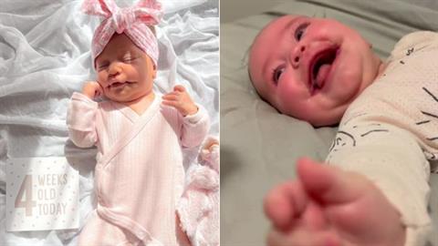 Μωράκι γεννήθηκε με «μόνιμο χαμόγελο» λόγω σπάνιας πάθησης!