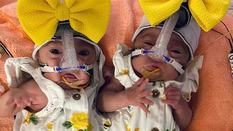 Γέννησε τις δίδυμες κορούλες της με 3 μέρες διαφορά!