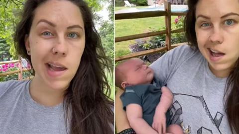 Σπάνια παρενέργεια της εγκυμοσύνης την άφησε με παραμορφωμένο πρόσωπο!