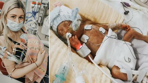 «Η αγκαλιά μου βοήθησε το πρόωρο μωρό μου να σωθεί - ήταν ένα θαύμα!»