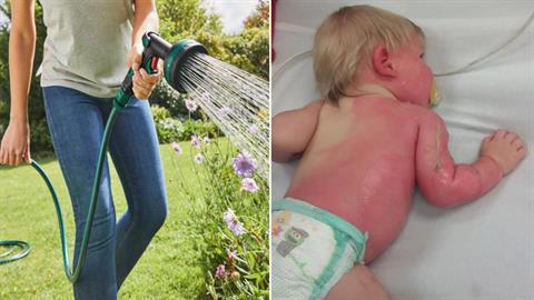 Μωρό έπαθε σοβαρά εγκαύματα από καυτό νερό - το έβρεξε η μαμά του με το λάστιχο