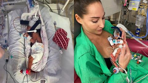 Προωράκι που γεννήθηκε στις 26 εβδομάδες δυναμώνει μέρα με τη μέρα!